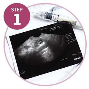 人工受孕步驟1-誘導排卵